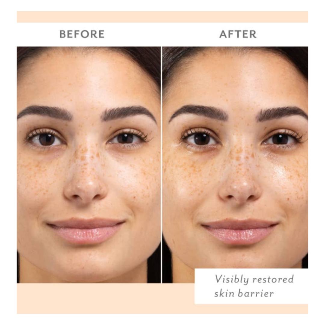 Skin Remedy Barrier-Boosting Sheet Mask